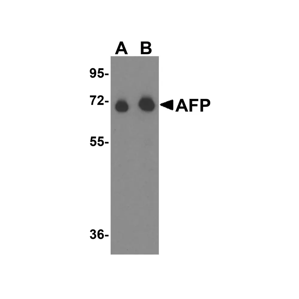 ProSci 5869 AFP Antibody, ProSci, 0.1 mg/Unit Primary Image