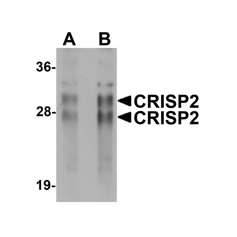 ProSci 5873_S CRISP2 Antibody, ProSci, 0.02 mg/Unit Primary Image