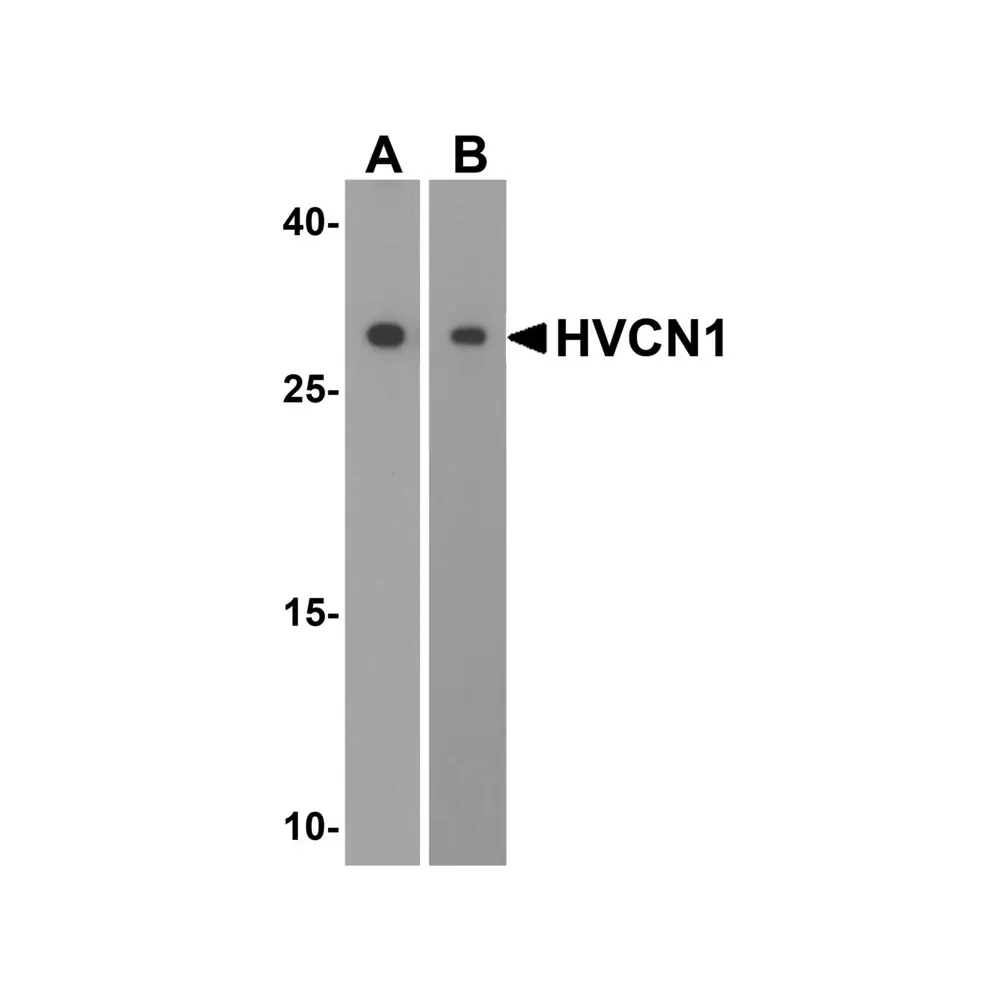 ProSci 5875_S HVCN1 Antibody, ProSci, 0.02 mg/Unit Primary Image