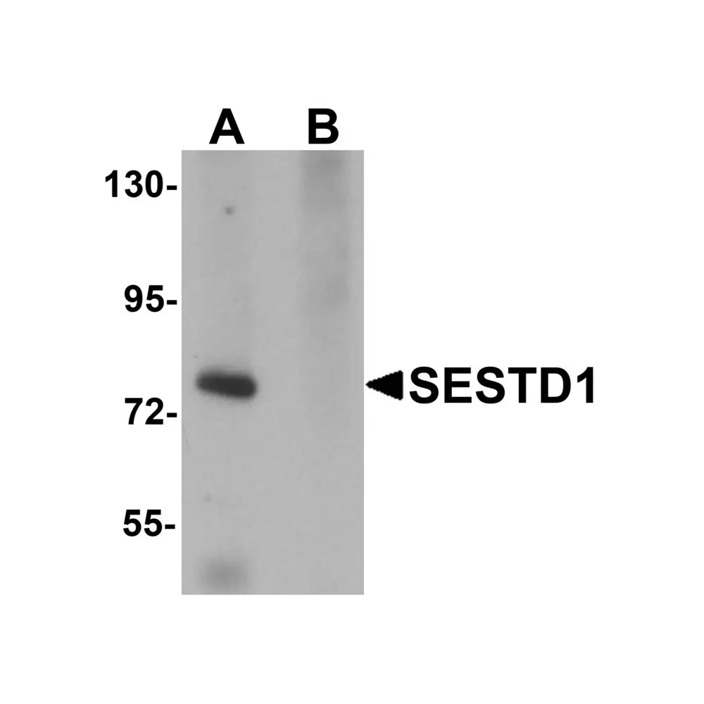 ProSci 5877 SESTD1 Antibody, ProSci, 0.1 mg/Unit Primary Image