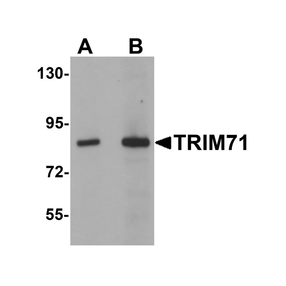 ProSci 5881_S TRIM71 Antibody, ProSci, 0.02 mg/Unit Primary Image