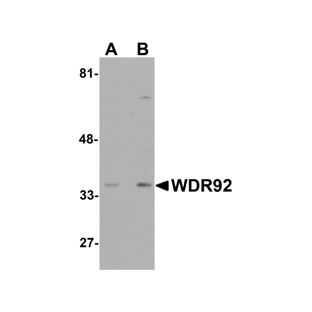 ProSci 5883 WDR92 Antibody, ProSci, 0.1 mg/Unit Primary Image