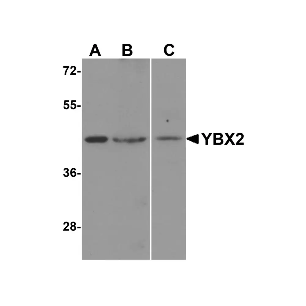 ProSci 5885_S YBX2 Antibody, ProSci, 0.02 mg/Unit Primary Image