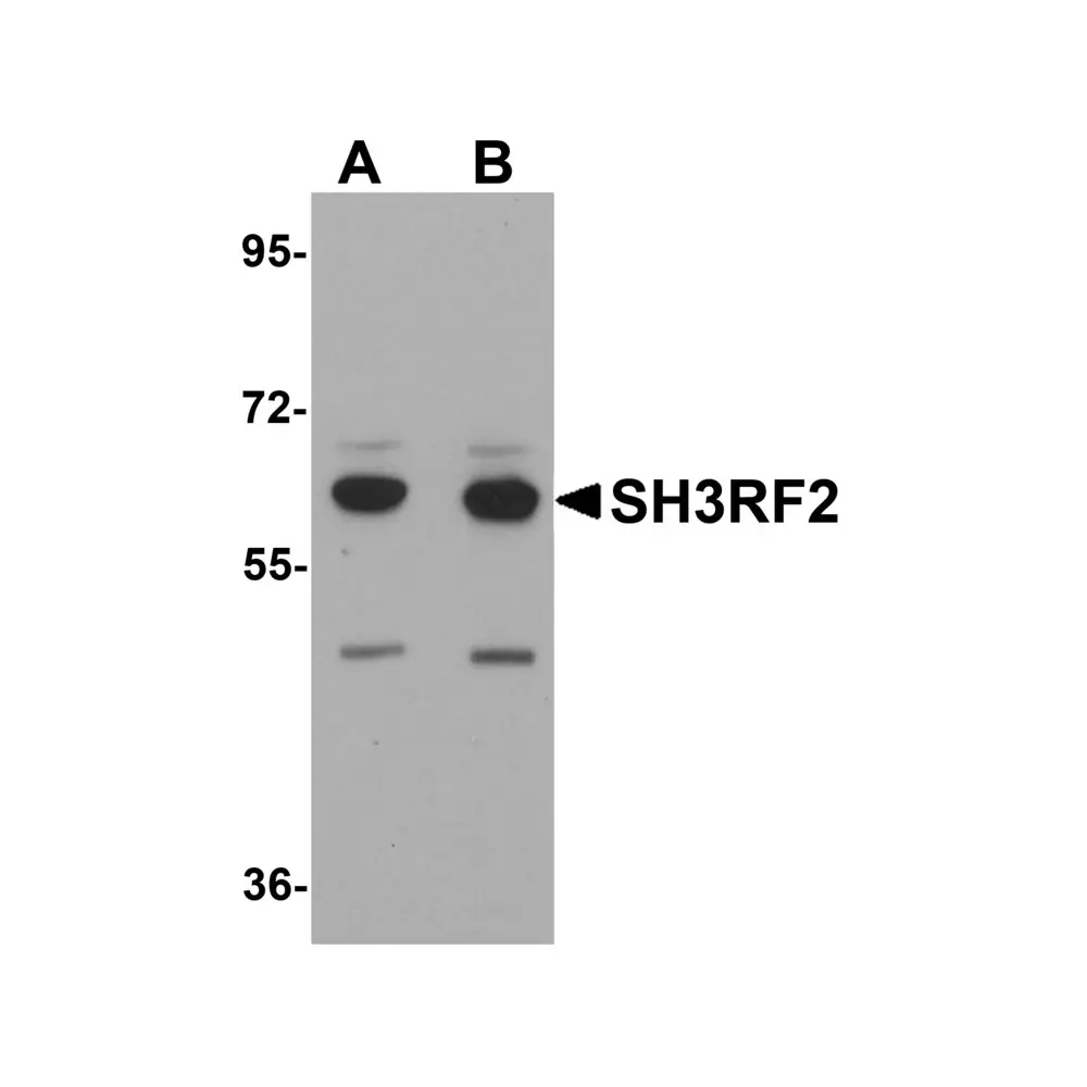 ProSci 5887_S SH3RF2 Antibody, ProSci, 0.02 mg/Unit Primary Image
