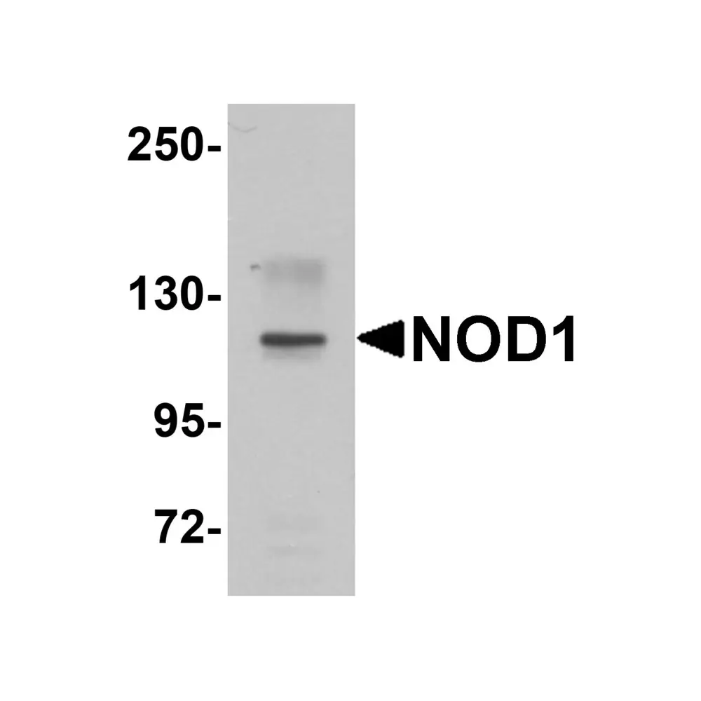 ProSci 5947 NOD1 Antibody, ProSci, 0.1 mg/Unit Primary Image