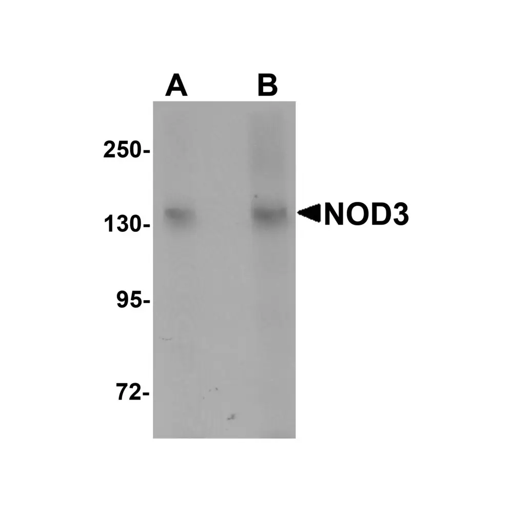 ProSci 5949 NOD3 Antibody, ProSci, 0.1 mg/Unit Primary Image
