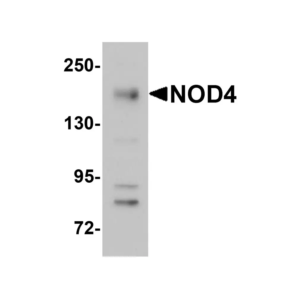 ProSci 5951 NOD4 Antibody, ProSci, 0.1 mg/Unit Primary Image