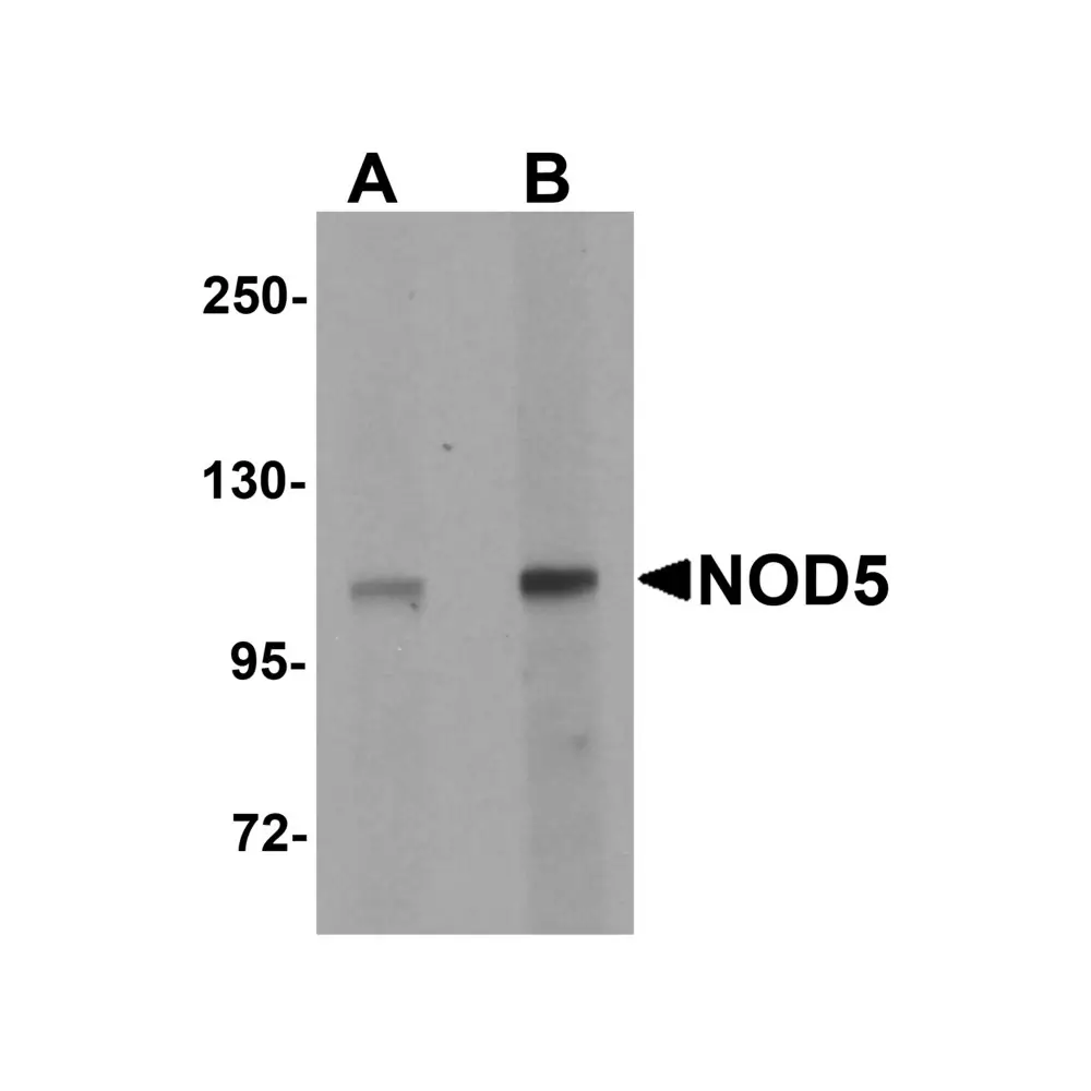 ProSci 5953 NOD5 Antibody, ProSci, 0.1 mg/Unit Primary Image