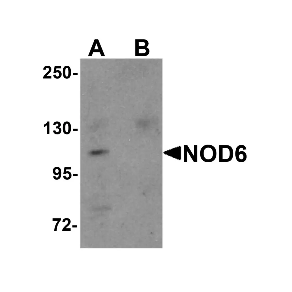 ProSci 5955 NOD6 Antibody, ProSci, 0.1 mg/Unit Primary Image