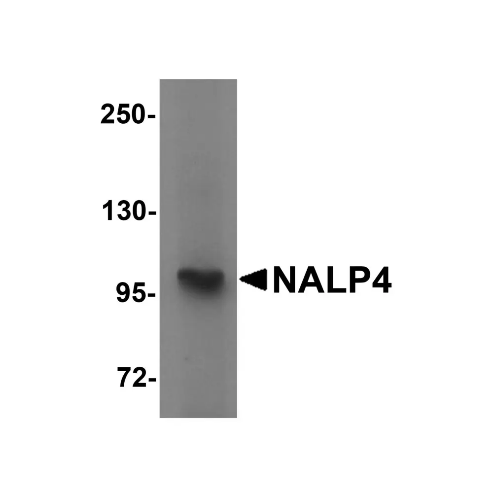 ProSci 5957 NALP4 Antibody, ProSci, 0.1 mg/Unit Primary Image