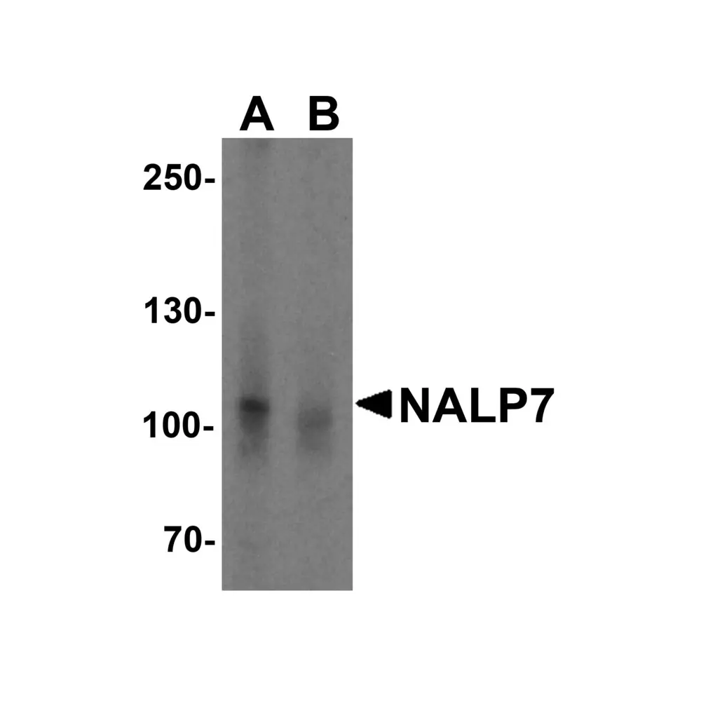 ProSci 5963_S NALP7 Antibody, ProSci, 0.02 mg/Unit Primary Image
