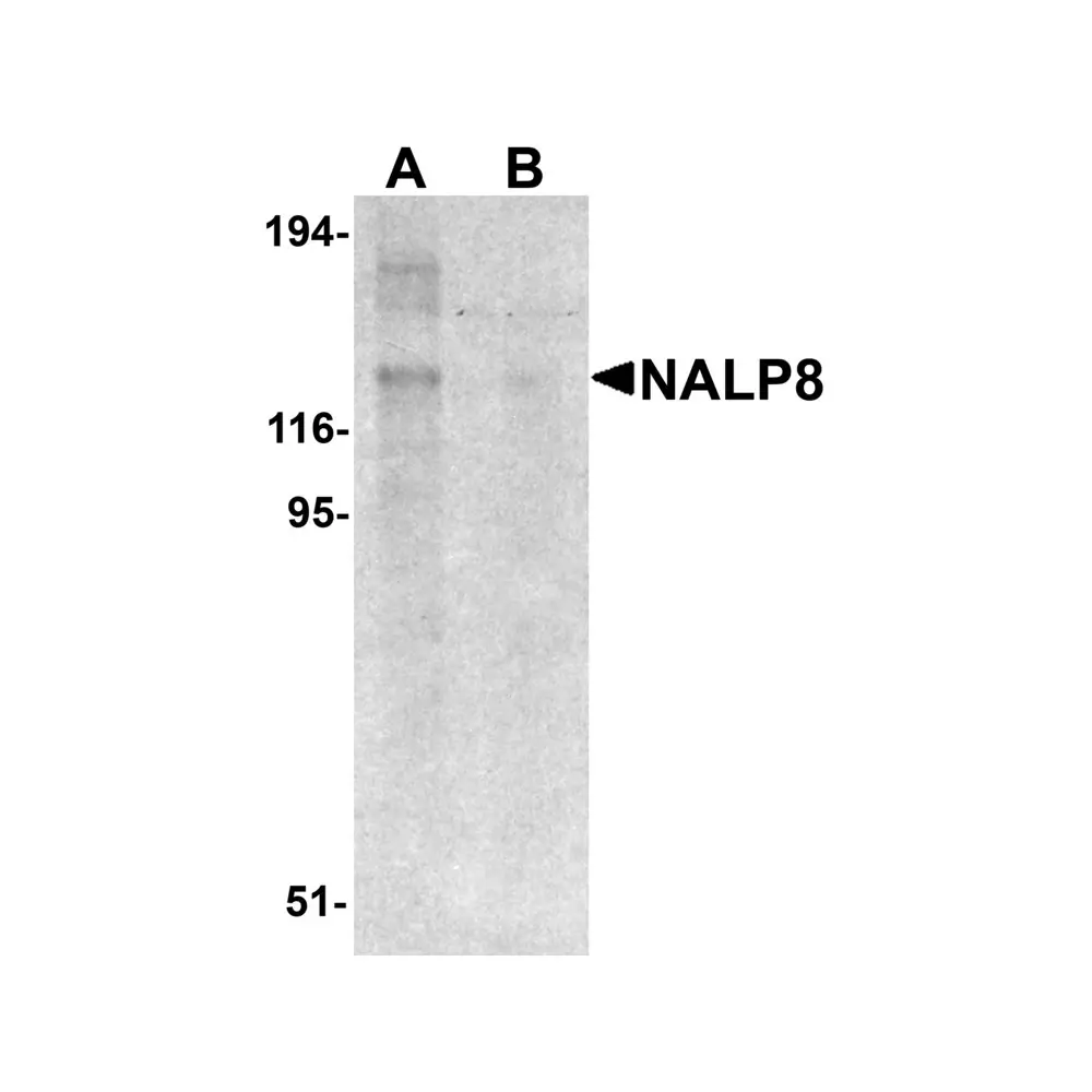 ProSci 5965_S NALP8 Antibody, ProSci, 0.02 mg/Unit Primary Image