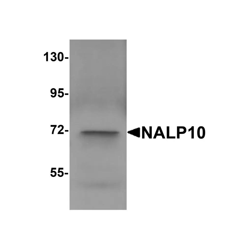 ProSci 5967 NALP10 Antibody, ProSci, 0.1 mg/Unit Primary Image