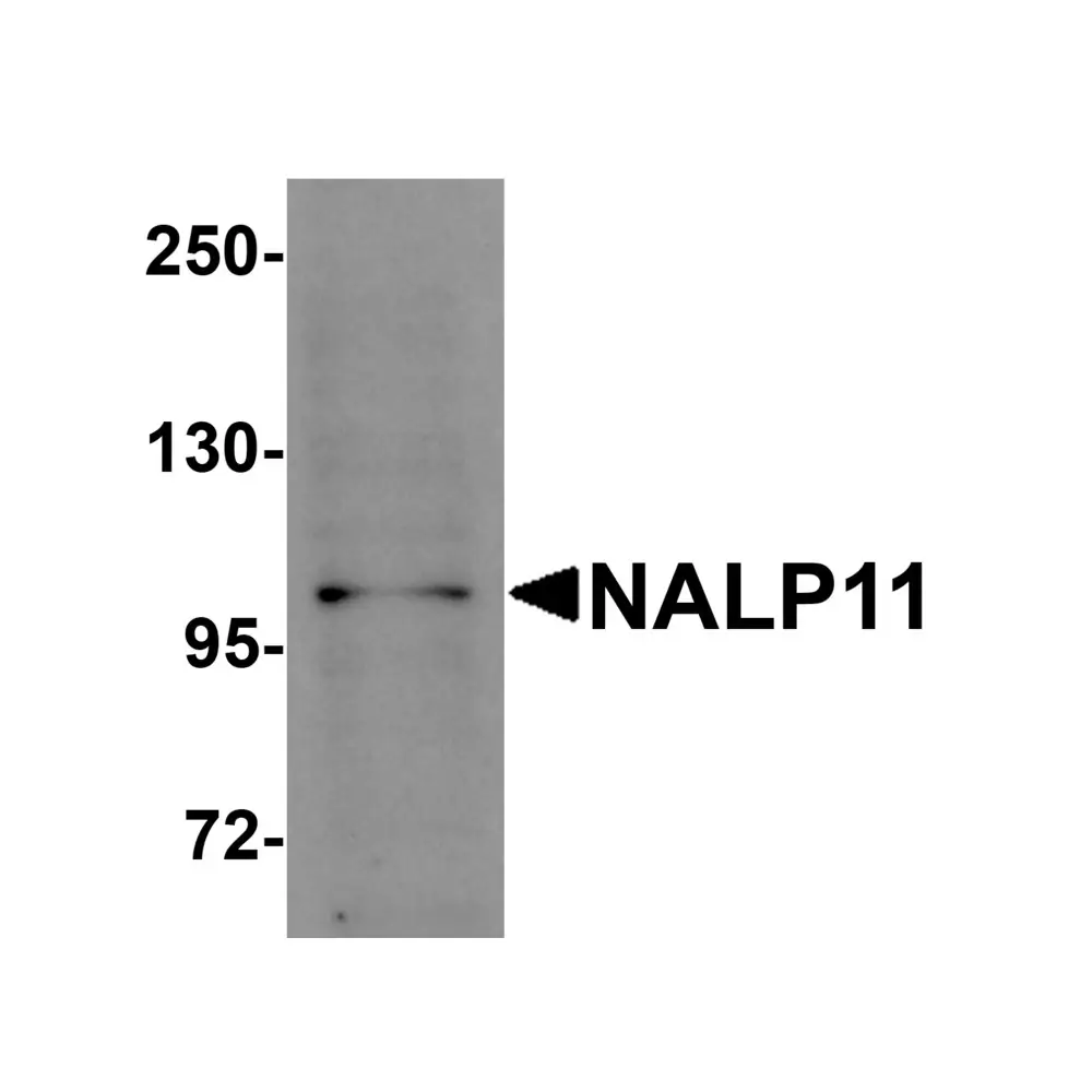 ProSci 5969 NALP11 Antibody, ProSci, 0.1 mg/Unit Primary Image