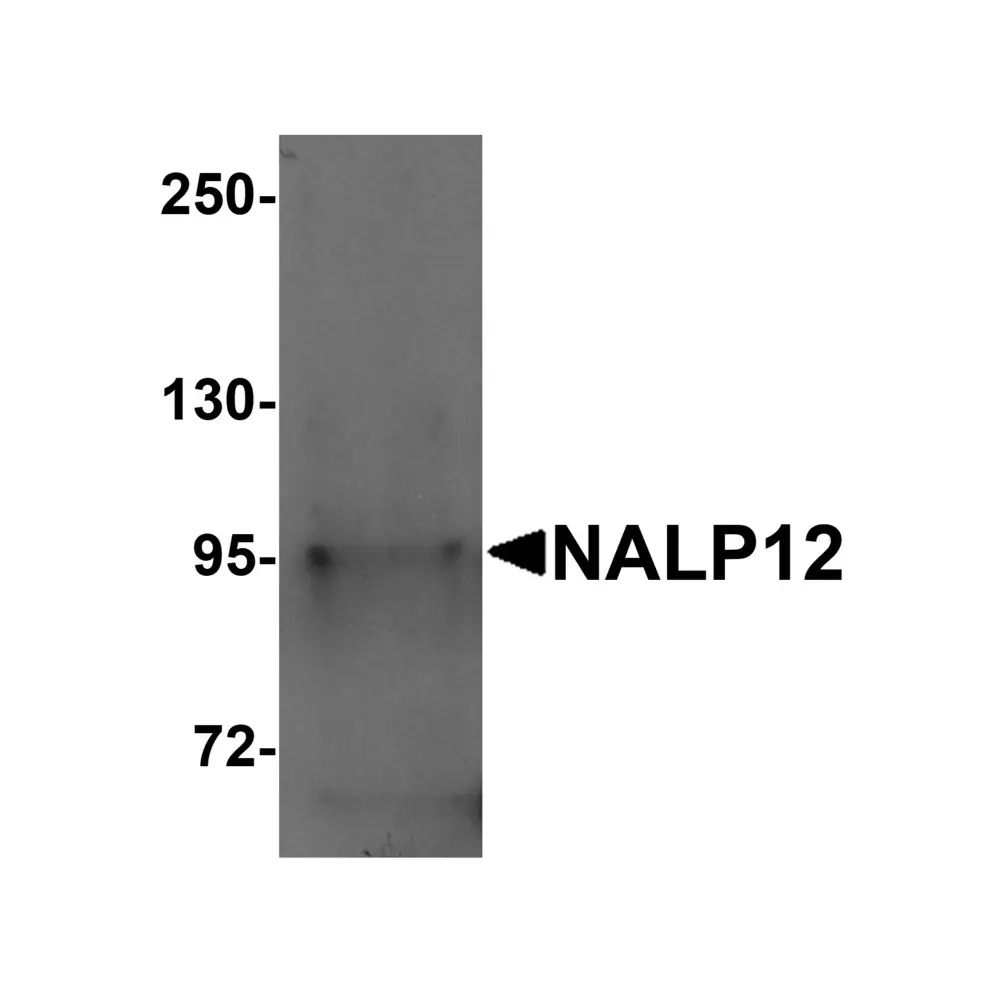 ProSci 5971 NALP12 Antibody, ProSci, 0.1 mg/Unit Primary Image