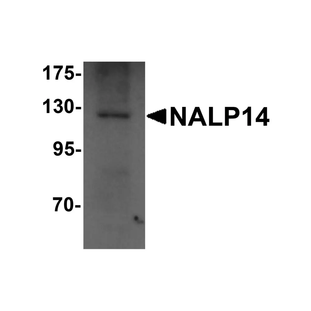 ProSci 5975 NALP14 Antibody, ProSci, 0.1 mg/Unit Primary Image