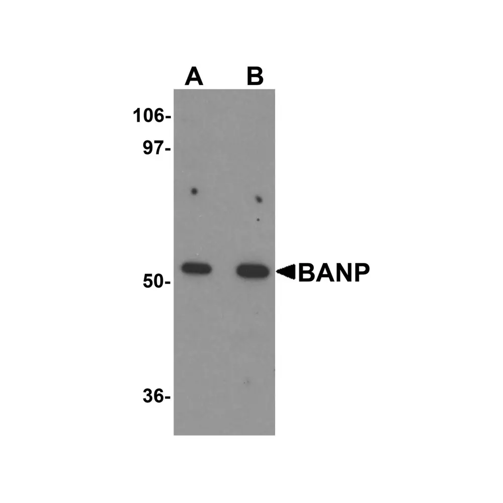 ProSci 5977 BANP Antibody, ProSci, 0.1 mg/Unit Primary Image