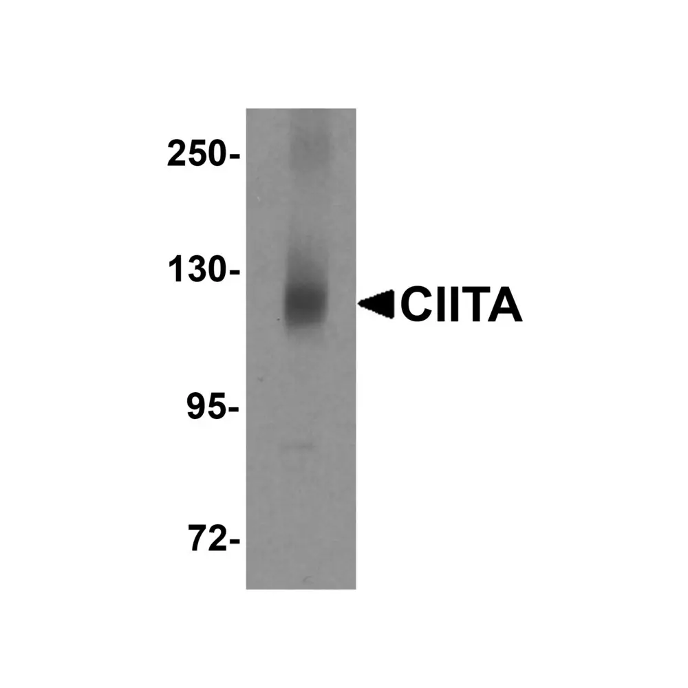 ProSci 5979_S CIITA Antibody, ProSci, 0.02 mg/Unit Primary Image