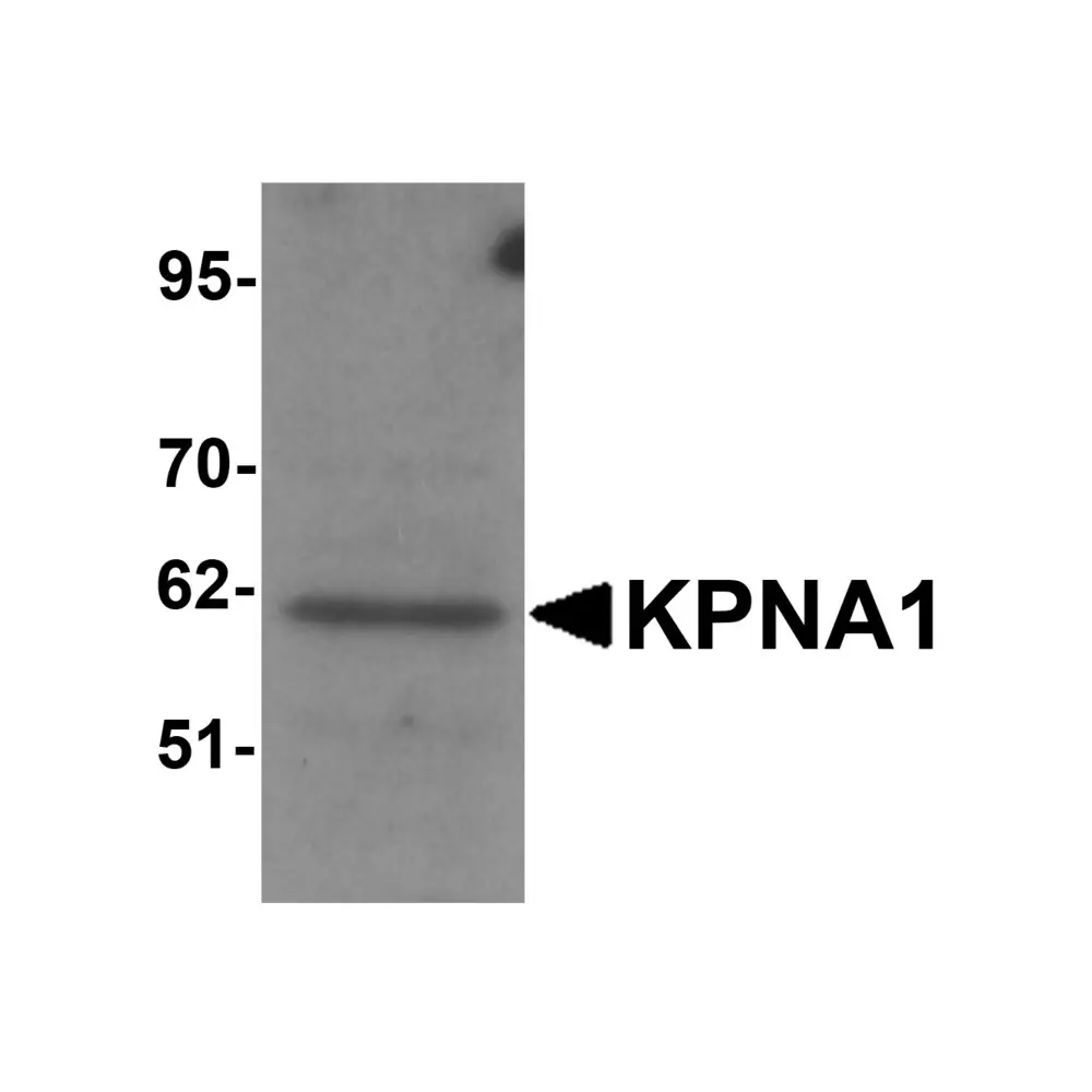 ProSci 5981 KPNA1 Antibody, ProSci, 0.1 mg/Unit Primary Image