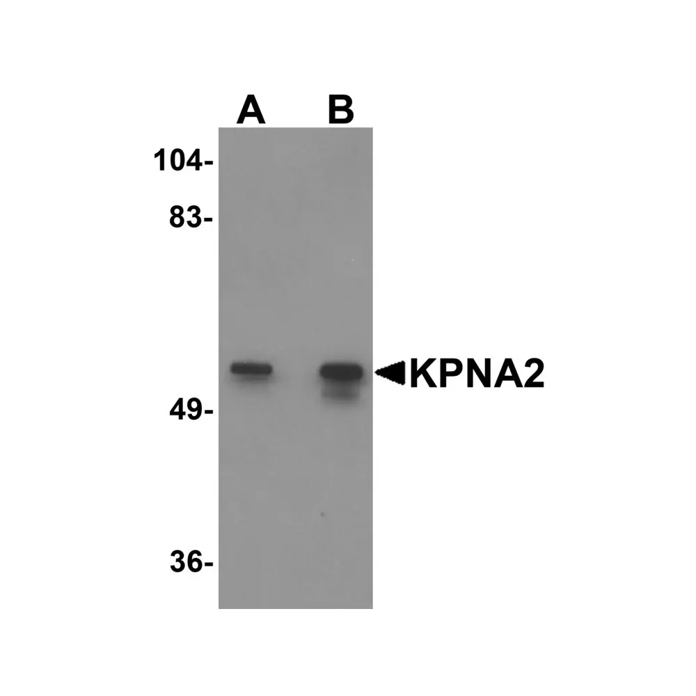 ProSci 5983_S KPNA2 Antibody, ProSci, 0.02 mg/Unit Primary Image
