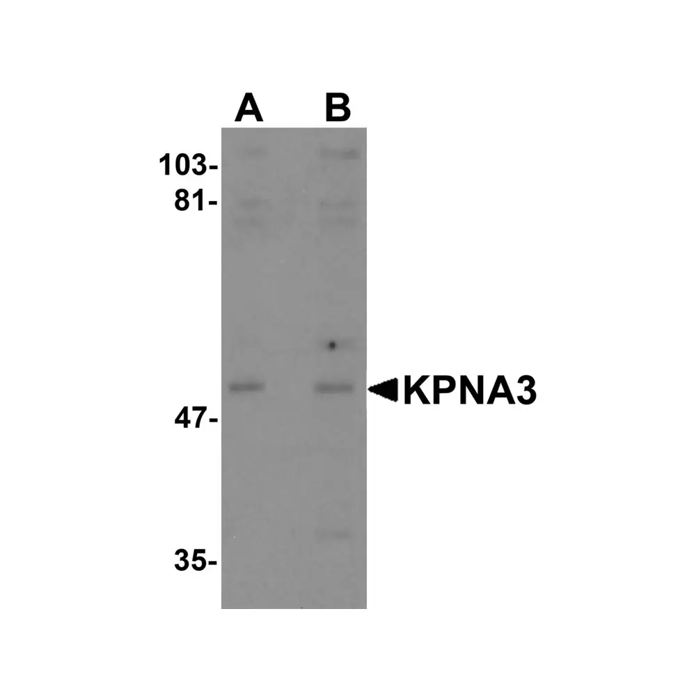 ProSci 5985 KPNA3 Antibody, ProSci, 0.1 mg/Unit Primary Image