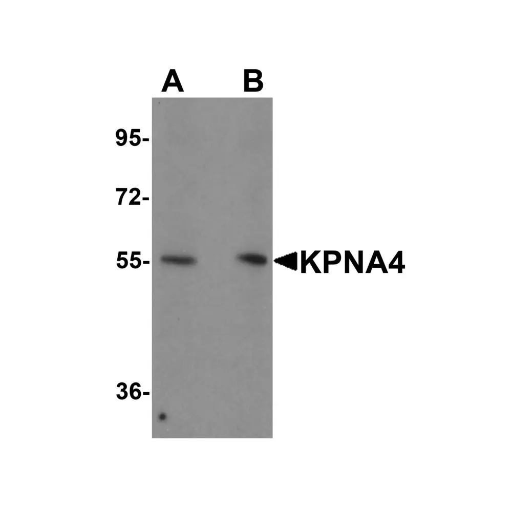 ProSci 5987 KPNA4 Antibody, ProSci, 0.1 mg/Unit Primary Image