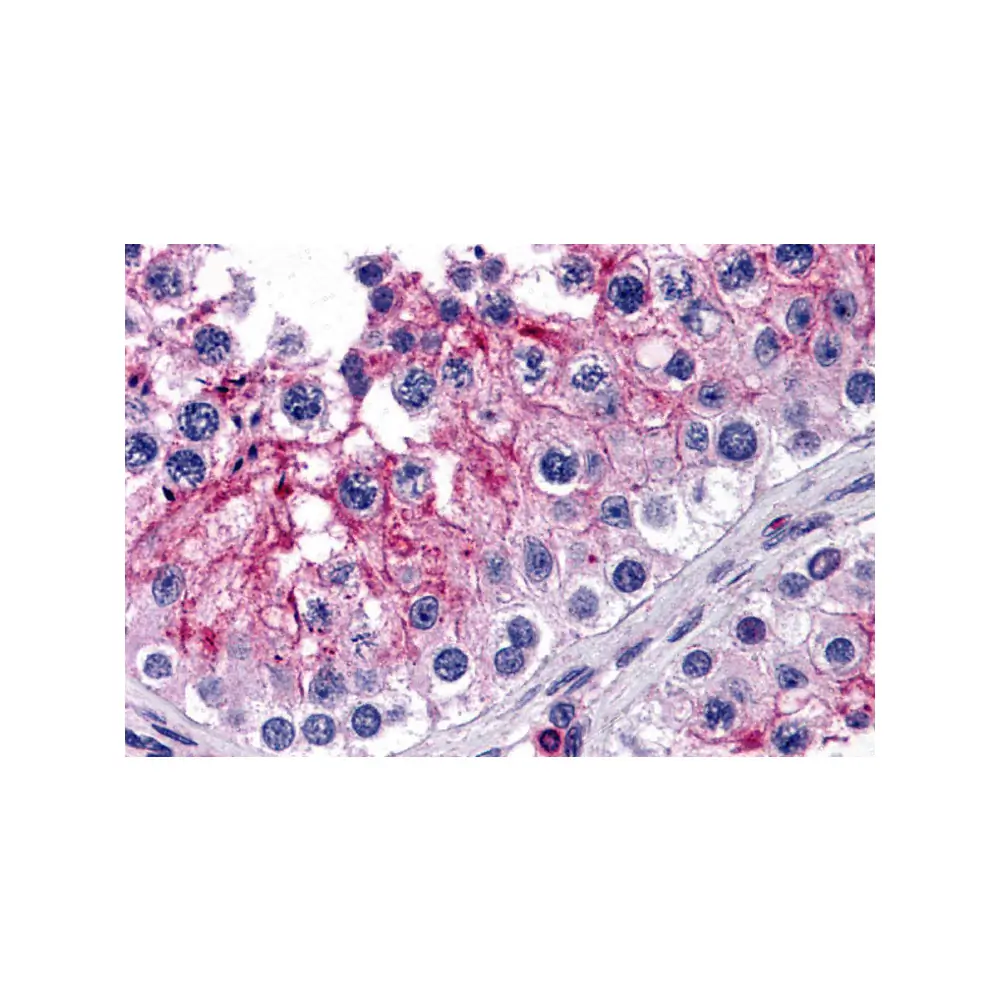 ProSci 5989_S KPNA5 Antibody, ProSci, 0.02 mg/Unit Primary Image