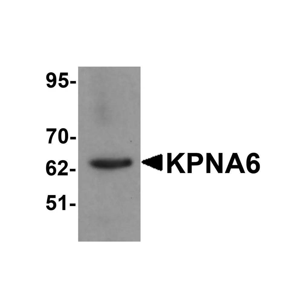 ProSci 5991_S KPNA6 Antibody, ProSci, 0.02 mg/Unit Primary Image