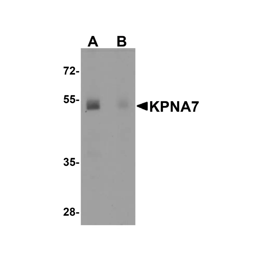 ProSci 5993 KPNA7 Antibody, ProSci, 0.1 mg/Unit Primary Image