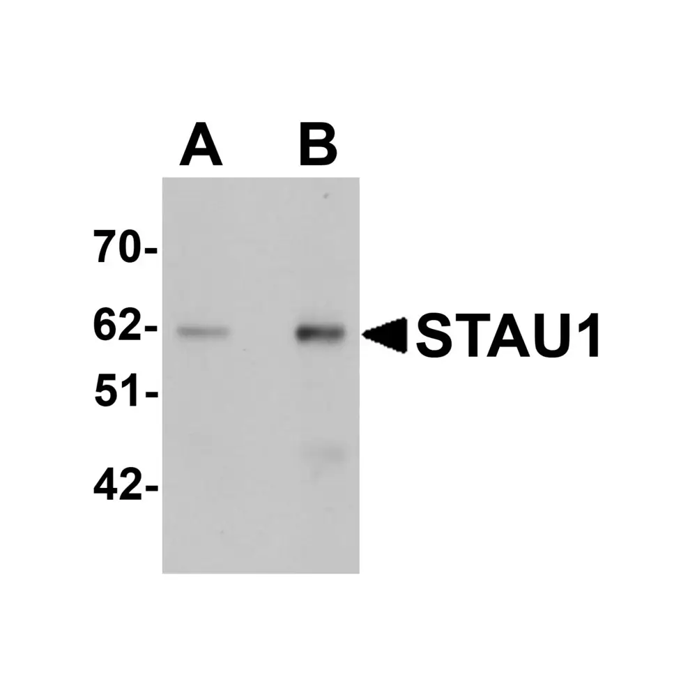 ProSci 5997 STAU1 Antibody, ProSci, 0.1 mg/Unit Primary Image