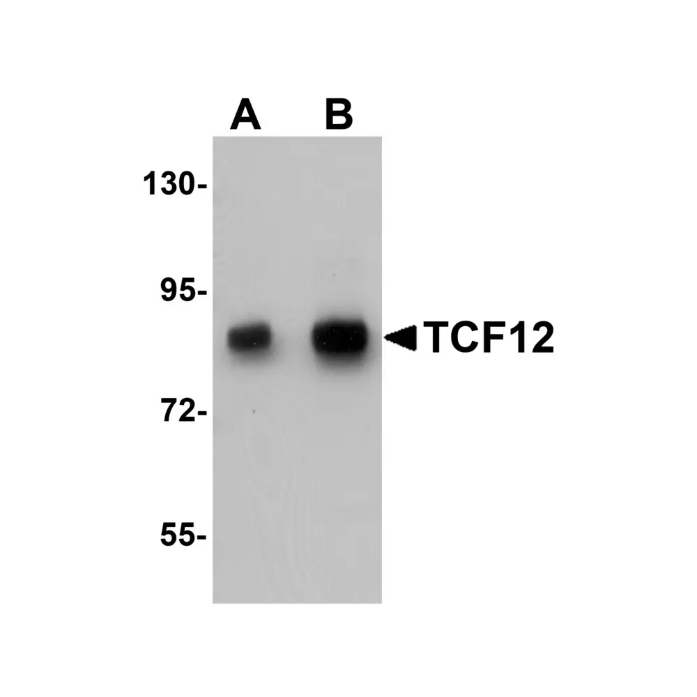 ProSci 5999 TCF12 Antibody, ProSci, 0.1 mg/Unit Primary Image
