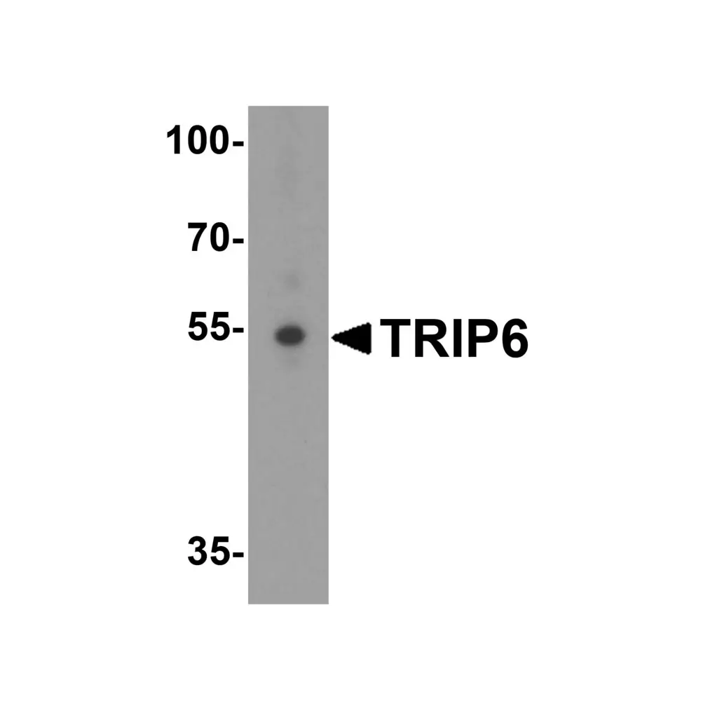 ProSci 6001 TRIP6 Antibody, ProSci, 0.1 mg/Unit Primary Image