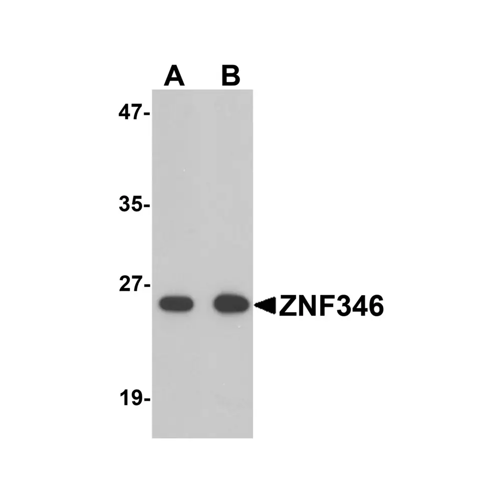 ProSci 6003_S ZNF346 Antibody, ProSci, 0.02 mg/Unit Primary Image