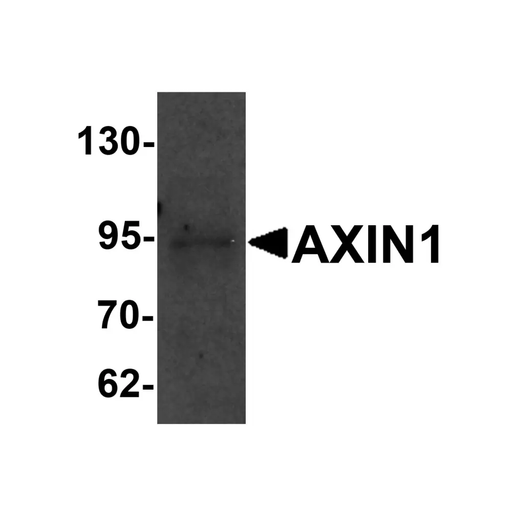 ProSci 6005_S AXIN1 Antibody, ProSci, 0.02 mg/Unit Primary Image