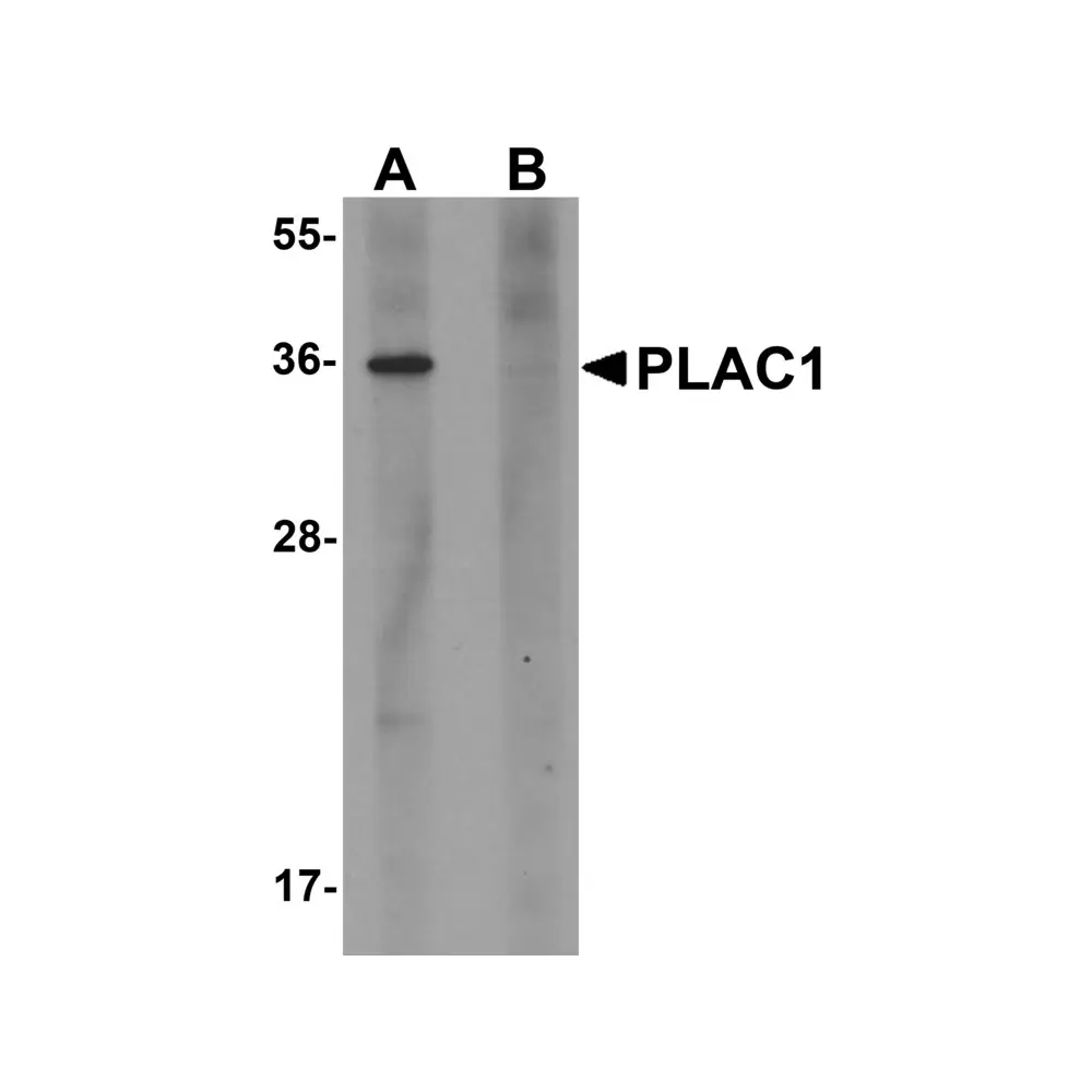 ProSci 6015 PLAC1 Antibody, ProSci, 0.1 mg/Unit Primary Image
