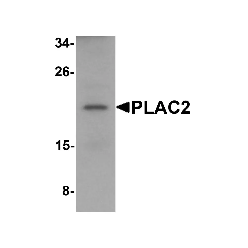 ProSci 6017_S PLAC2 Antibody, ProSci, 0.02 mg/Unit Primary Image