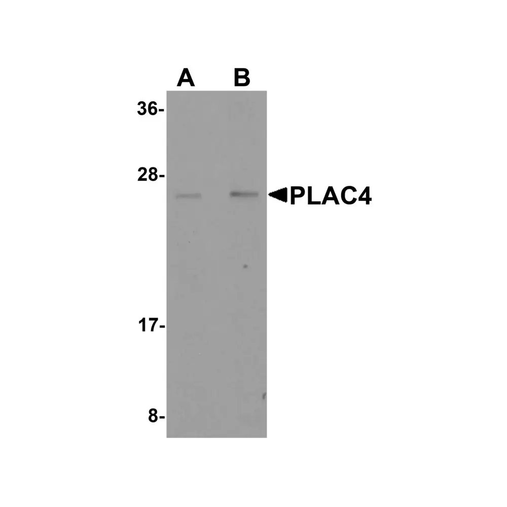 ProSci 6021 PLAC4 Antibody, ProSci, 0.1 mg/Unit Primary Image