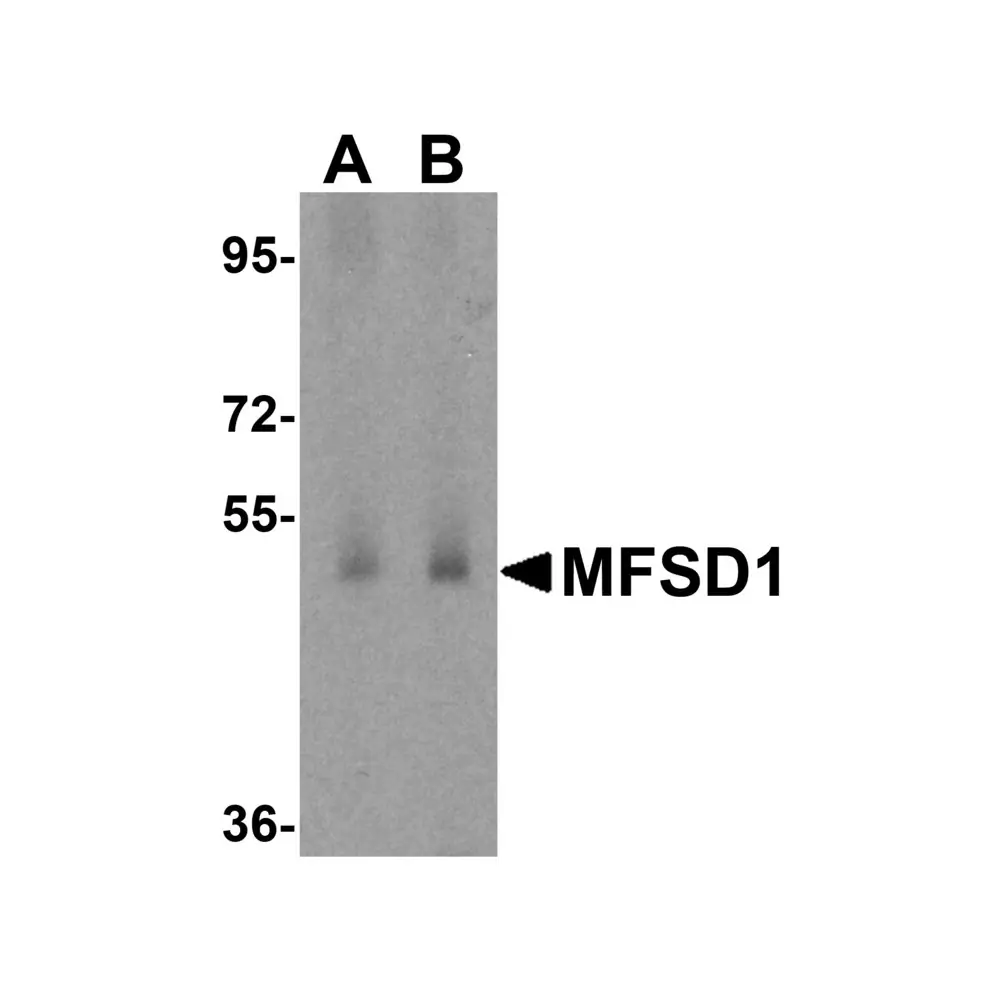 ProSci 6023 MFSD1 Antibody, ProSci, 0.1 mg/Unit Primary Image