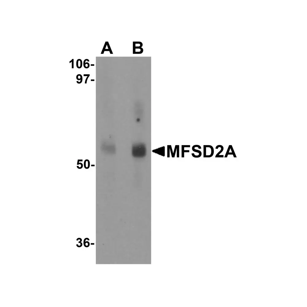 ProSci 6025 MFSD2A Antibody, ProSci, 0.1 mg/Unit Primary Image