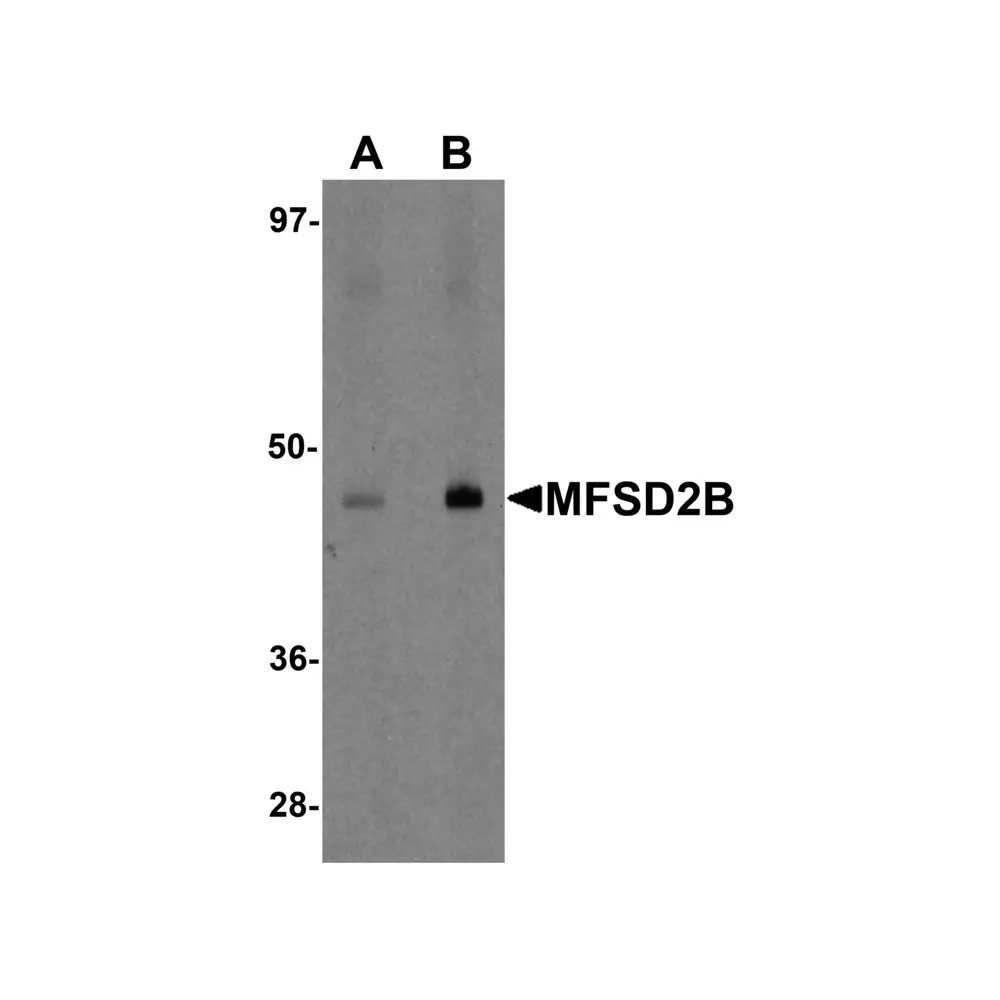 ProSci 6027 MFSD2B Antibody, ProSci, 0.1 mg/Unit Primary Image