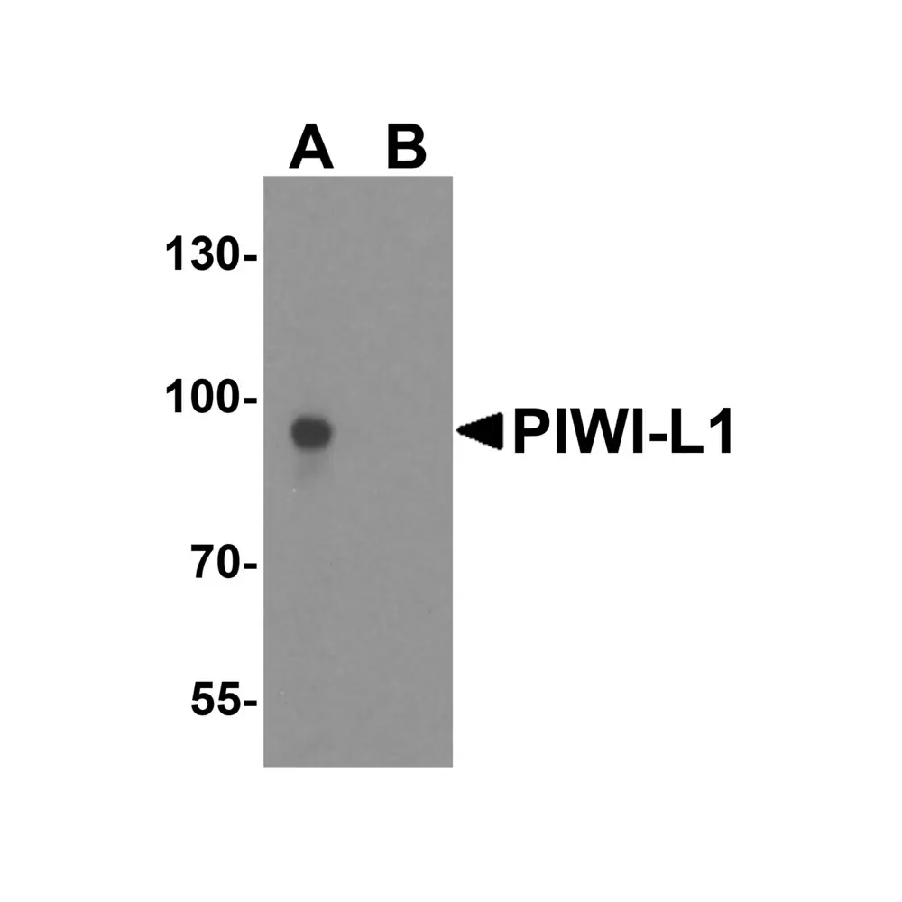 ProSci 6029 PIWI-L1 Antibody, ProSci, 0.1 mg/Unit Primary Image