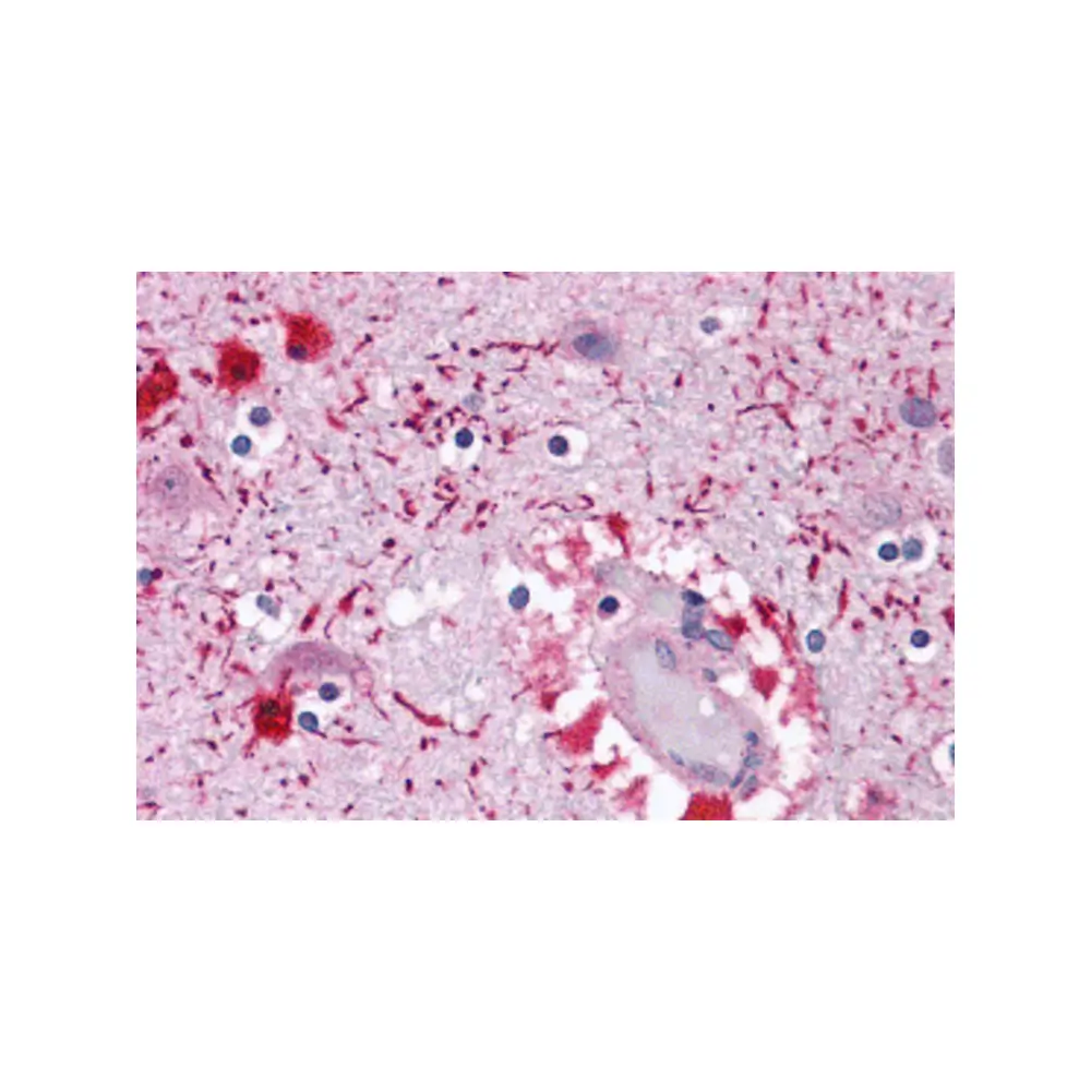 ProSci 6031_S PIWI-L2 Antibody, ProSci, 0.02 mg/Unit Primary Image