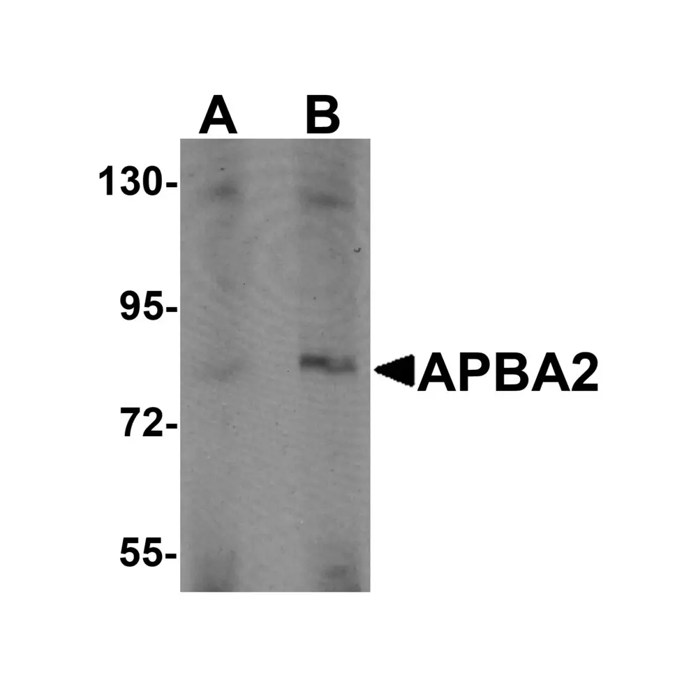 ProSci 6039_S APBA2 Antibody, ProSci, 0.02 mg/Unit Primary Image