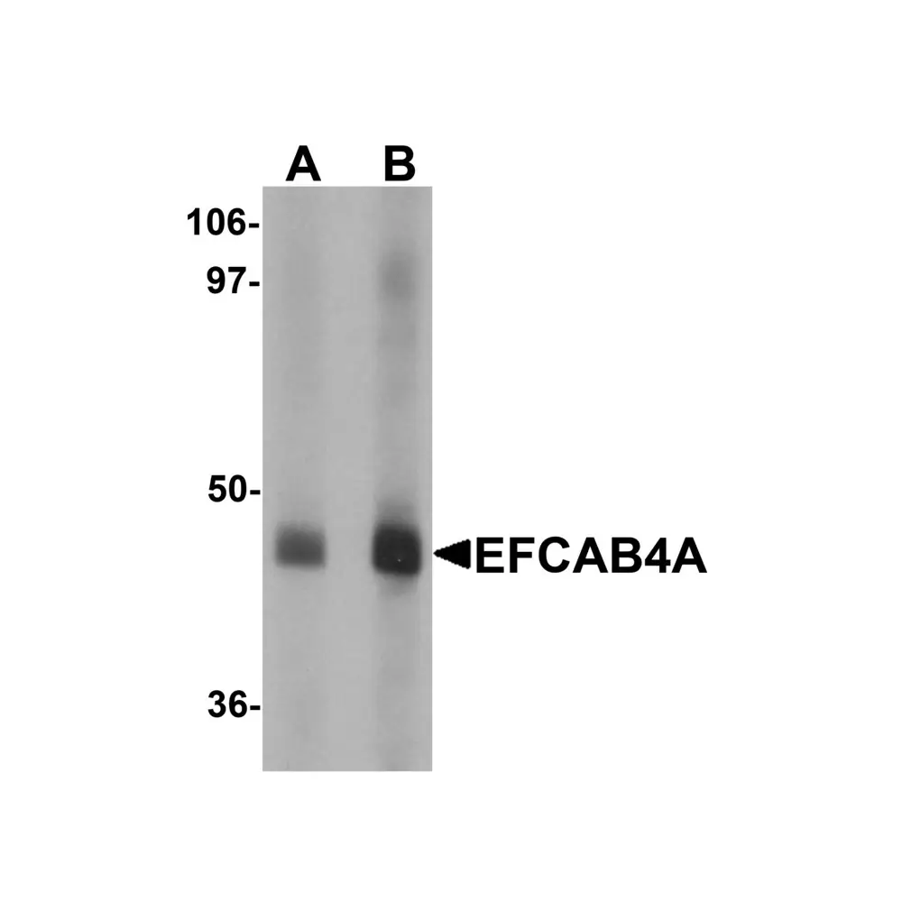 ProSci 6043_S EFCAB4A Antibody, ProSci, 0.02 mg/Unit Primary Image