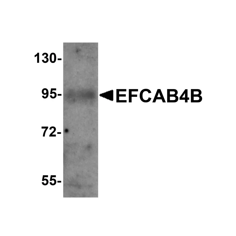 ProSci 6045 EFCAB4B Antibody, ProSci, 0.1 mg/Unit Primary Image