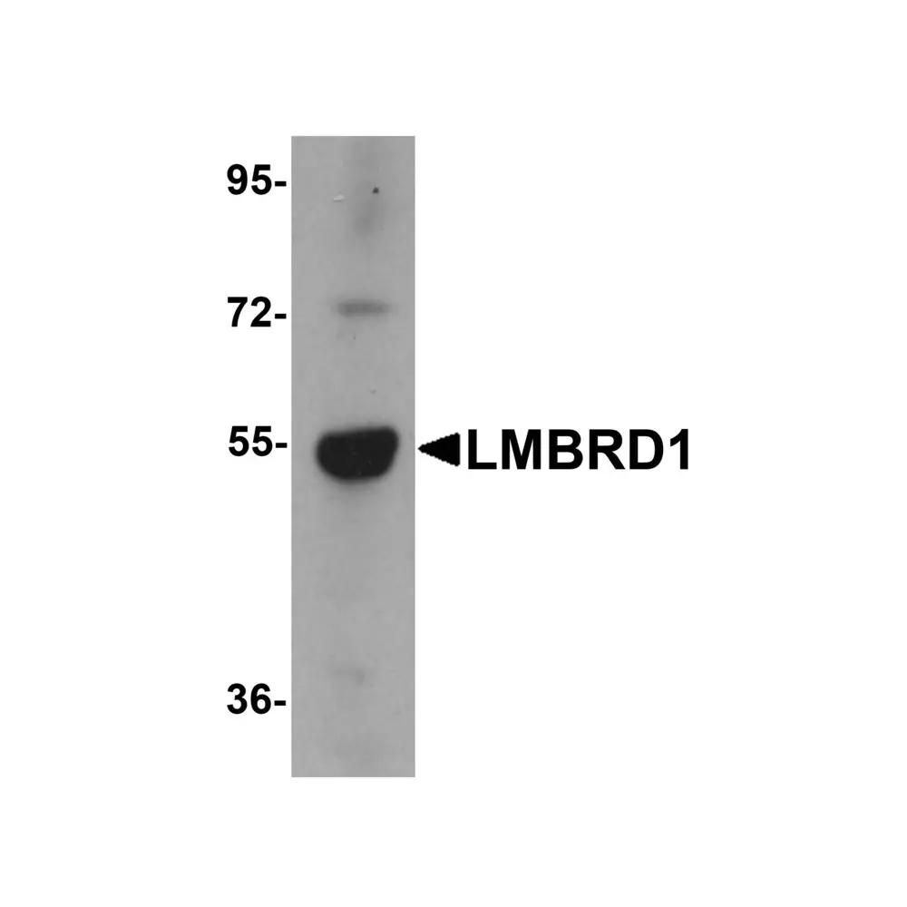 ProSci 6047 LMBRD1 Antibody, ProSci, 0.1 mg/Unit Primary Image