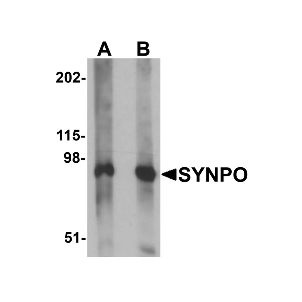 ProSci 6049 SYNPO Antibody, ProSci, 0.1 mg/Unit Primary Image