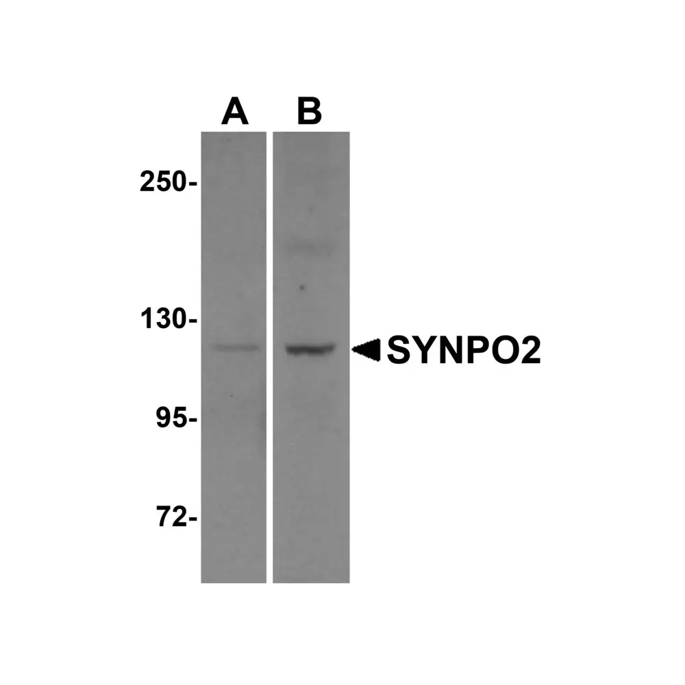 ProSci 6051 SYNPO2 Antibody, ProSci, 0.1 mg/Unit Primary Image