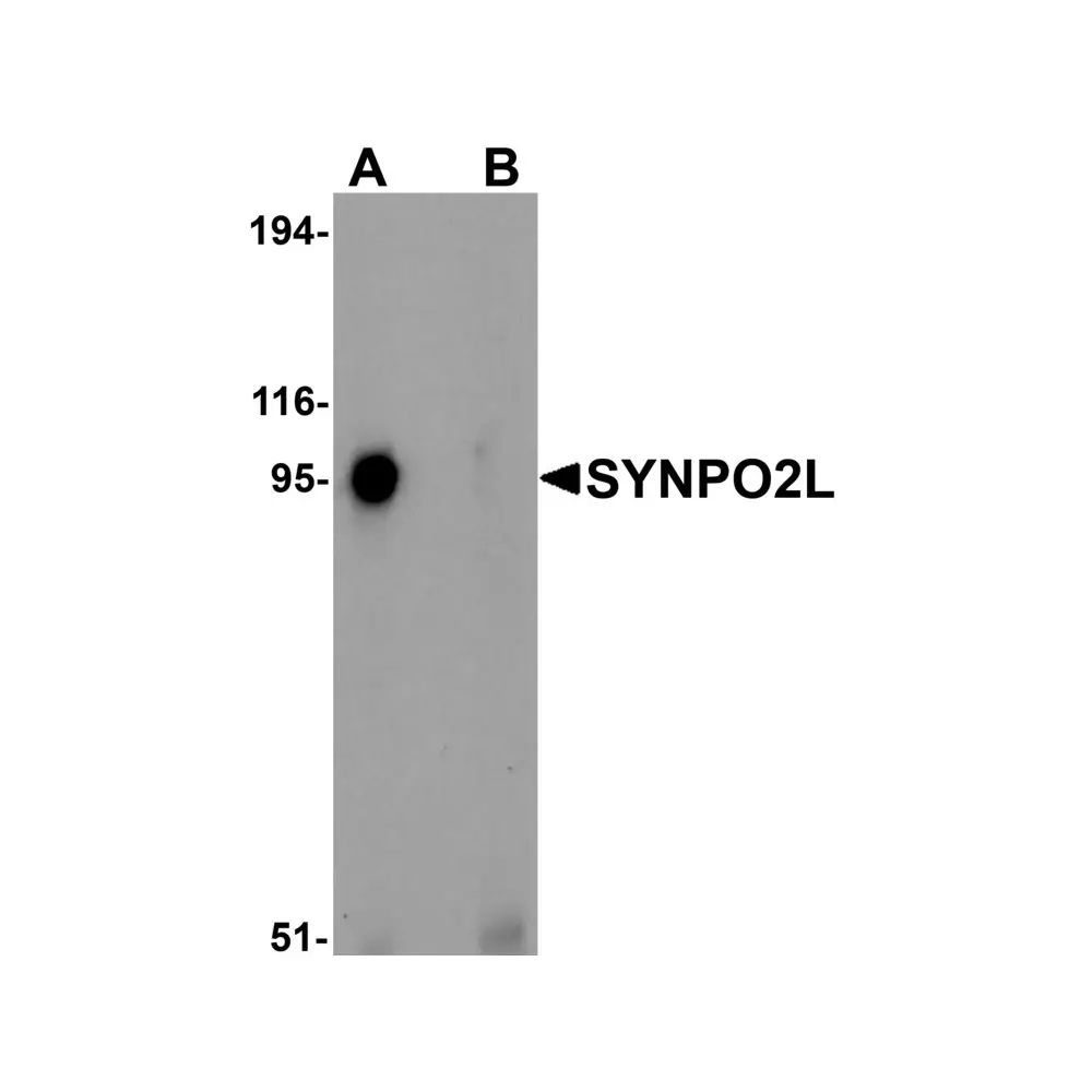ProSci 6053_S SYNPO2L Antibody, ProSci, 0.02 mg/Unit Primary Image