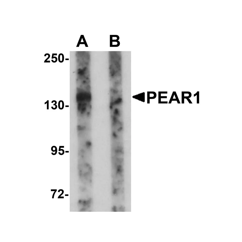 ProSci 6055 PEAR1 Antibody, ProSci, 0.1 mg/Unit Primary Image